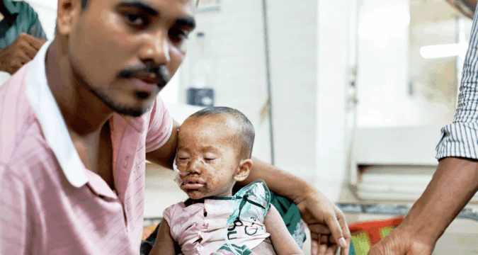 Catholic health centres respond to massive measles outbreak in Bangladesh